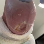 0964814 - PI stage 3 #1