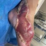 0995622 - photo 1 - 20240111