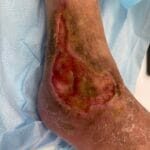 10839918 - Non-heeling - Photo #2