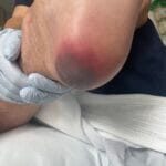 1147215 - Unstageable PI