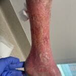 1195250 - Feature - 20240313