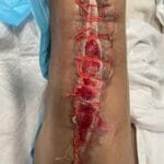 1461179 - Vac dressing - Photo #2