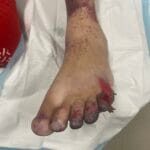 Arterial Stenosis - 1063636 - Photo 1