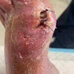 Gout - 0736712 - Photo 2