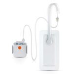 Smith+Nephew's PICO Single Use Negative Pressure Wound Therapy System